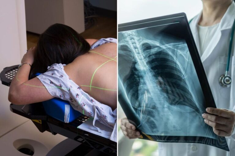 'Amazing' new lung cancer treatment 40% more effective than standard amid 'golden age' of cancer research

